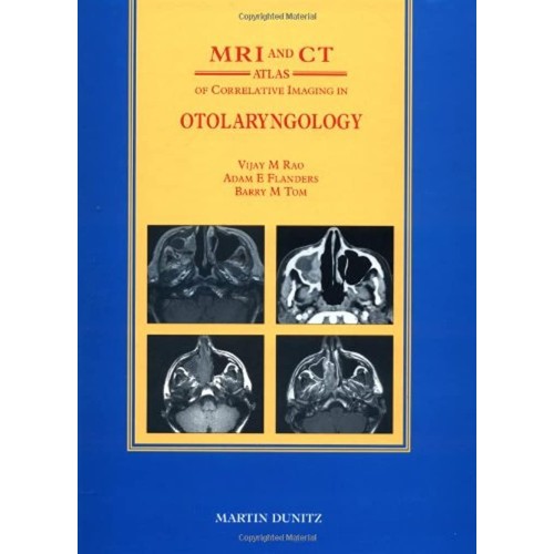 Mri And Ct Atlas Of Correlative Imaging In Ot...