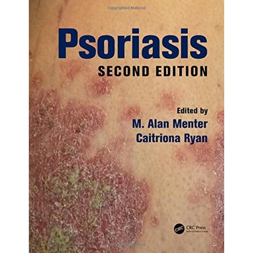 Psoriasis 2Ed (Hb 2017) 