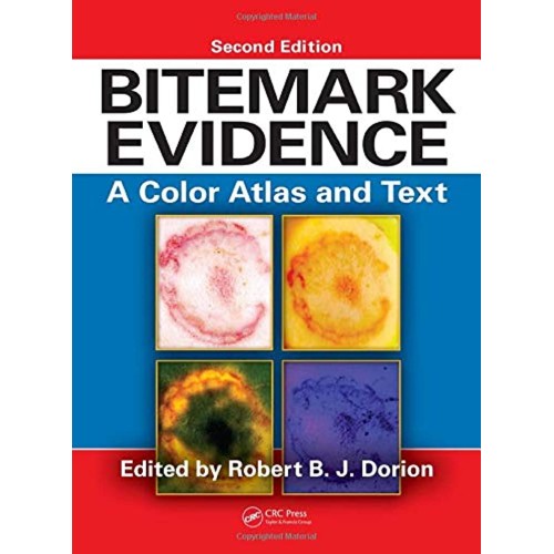 Bitemark Evidence A Color Atlas And Text 2Ed ...