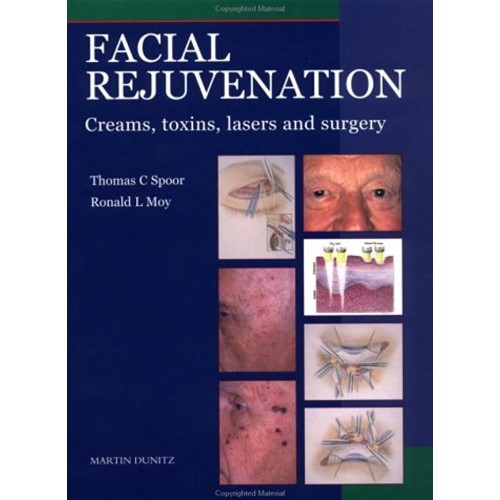 Facial Rejuvenation: Creams, Toxins, Scalpels...