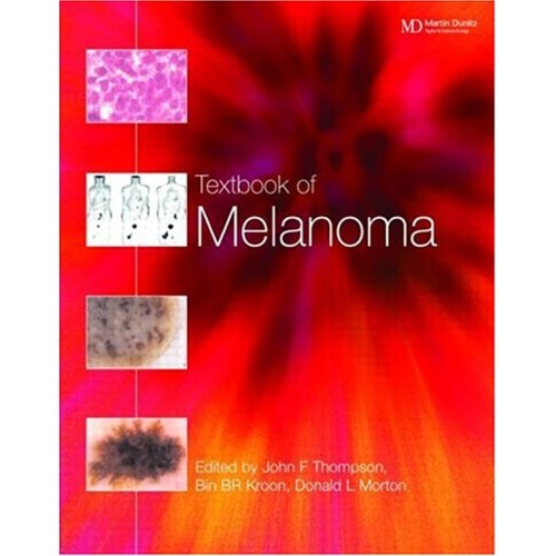 Textbook Of Melanoma (Hb 2003)