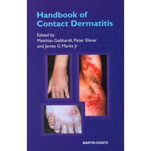 Handbook Of Contact Dermatitis 