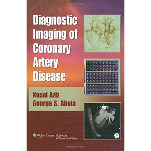 Diagnostic Imaging Of Coronary Artery Disease...