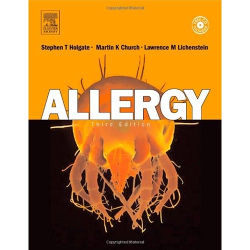 Allergy, 3/E, With Cd-Rom (Hb) 