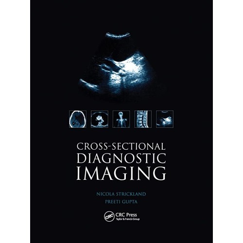 Cross-Sect Diagnostic Imaging 