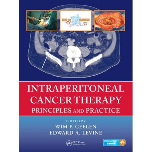 Intraperitoneal Cancer Therapy Principles And...