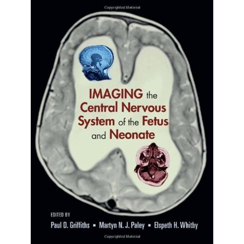 Imaging The Central Nervous System Of The Fet...