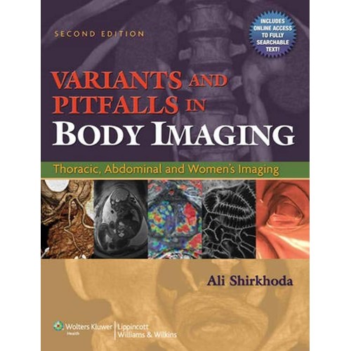 Variants & Pitfalls In Body Imaging: Thoracic...