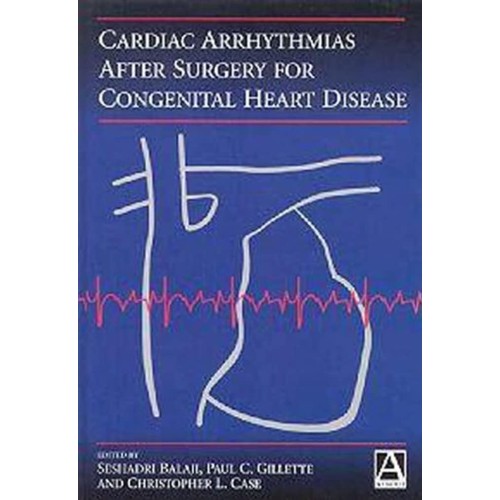 Cardiac Arrhythmias After Surgery For Congeni...