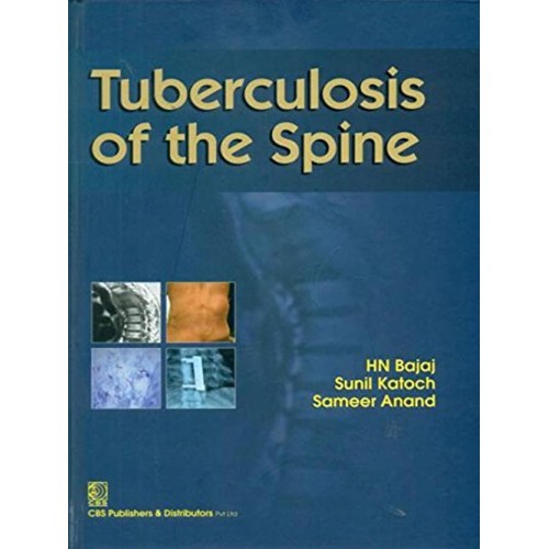 Tuberculosis Of The Spine (Hb 2014) 