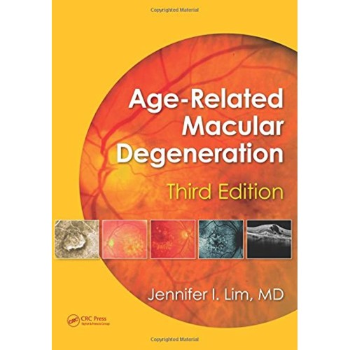 Age Related Macular Degeneration 3Ed (Hb 2013...