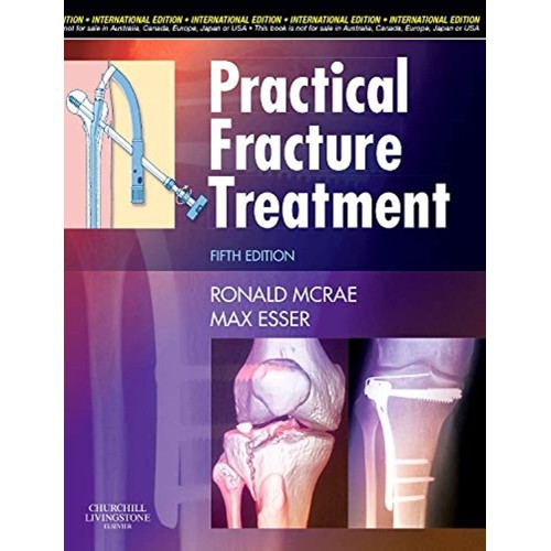 Practical Fracture Treatment (Ie) 5Ed (Pb 200...