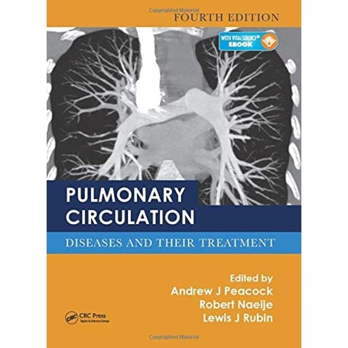 Pulmonary Circulation Diseases And Their Trea...