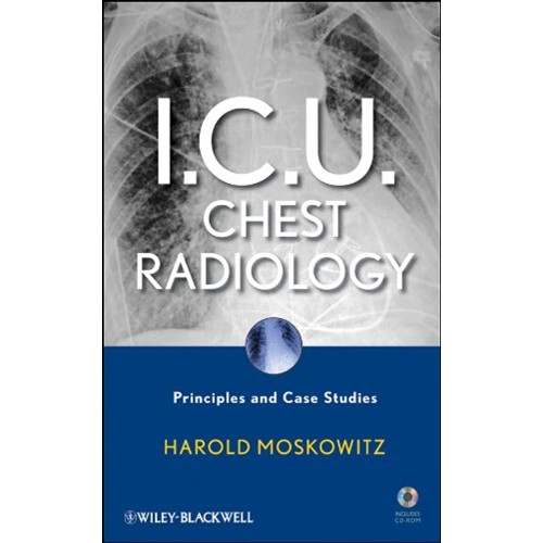 I C U Chest Radiology Principles And Case Stu...