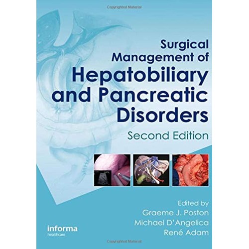 Surgical Management Of Hepatobiliary And Panc...