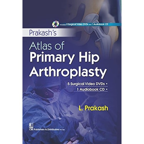 Atlas Of Primary Hip Arthroplasty 5 Surgical ...