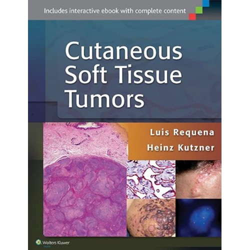 Cutaneous Soft Tissue Tumors (Hb 2015) 