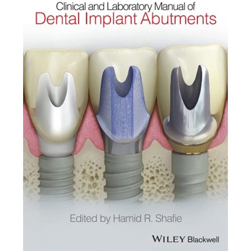 Clinical And Laboratory Manual Of Dental Impl...