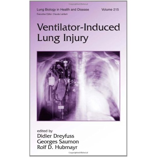 Ventilator Induced Lung Injury 