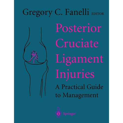 Posterior Cruciate Ligament Injuries 