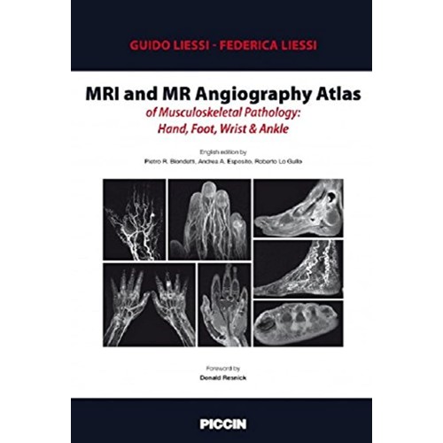 Mri And Mr Angiography Atlas Of Musculoskelet...