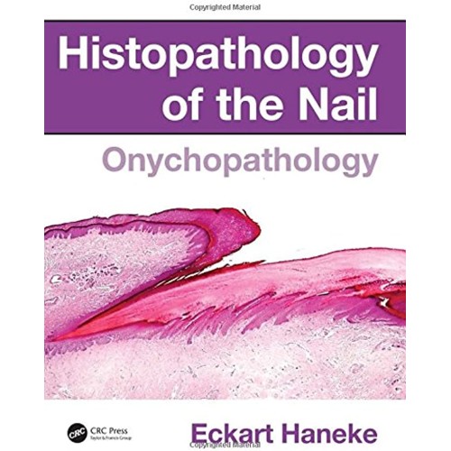 Histopathology Of The Nail Onychopathology (H...