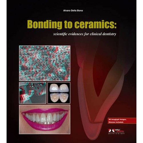 Bonding To Ceramics Scientific Evidences For ...