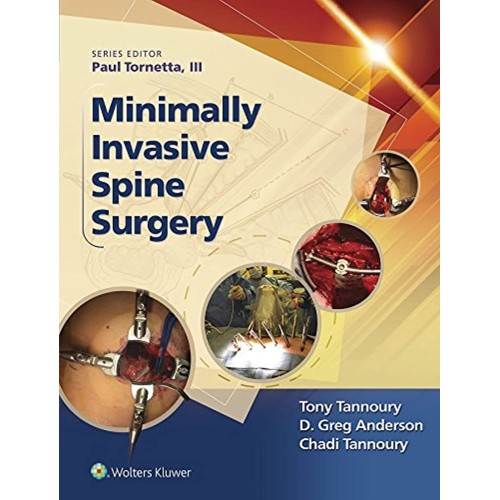 Minimally Invasive Spine Surgery (Hb 2017) 