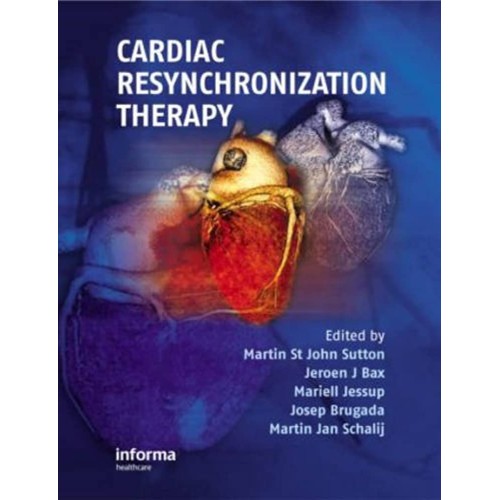 Cardiac Resynchronization Therapy 