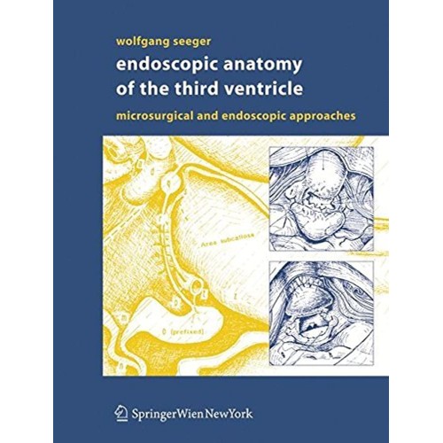 Endoscopic Anatomy Of The Third Ventricle (Hb...