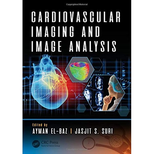 Cardiovascular Imaging And Image Analysis (Hb...