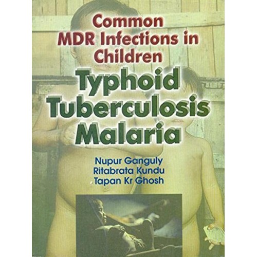 Common Mdr Infections In Children Typhoid Tub...