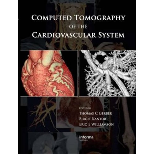 Computed Tomography Of The Cardiovascular Sys...