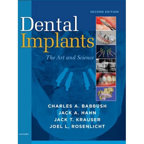 Dental Implants: The Art And Science, 2E (Hb ...