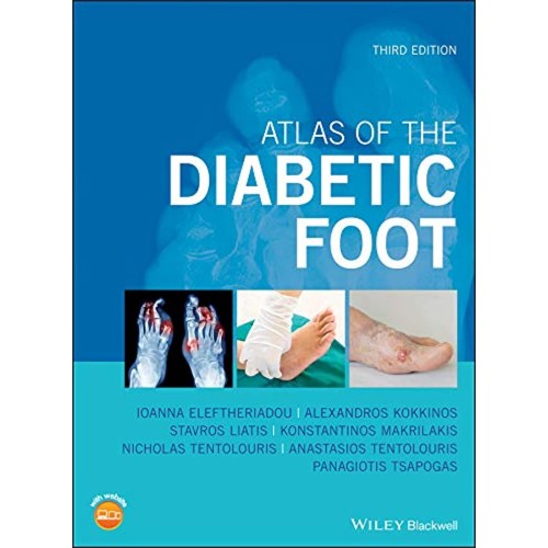 Atlas Of The Diabetic Foot 3Ed (Hb 2019) 