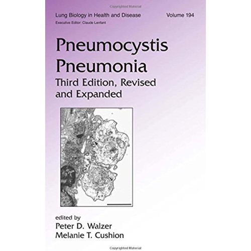 Pneumocystis Pneumonia-3Ed 