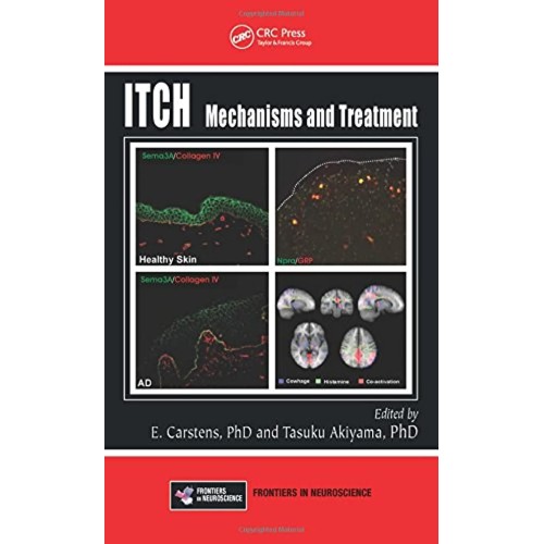 Itch: Mechanisms And Treatment (Hb 2014) 