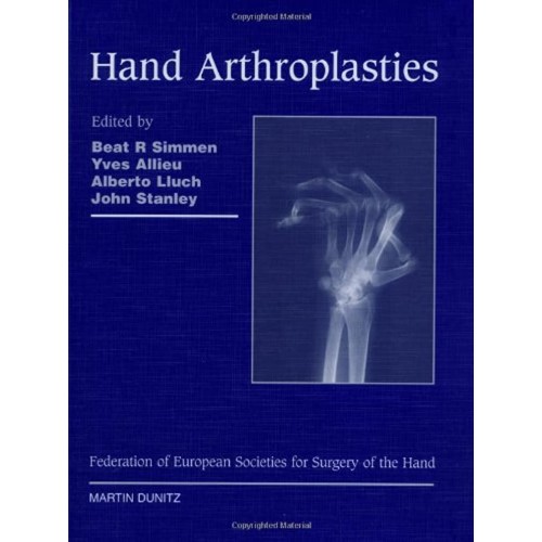 Hand Arthroplasties 