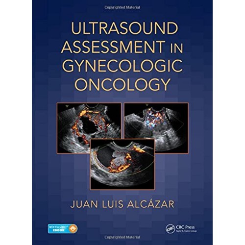 Ultrasound Assessment In Gynecologic Oncology...