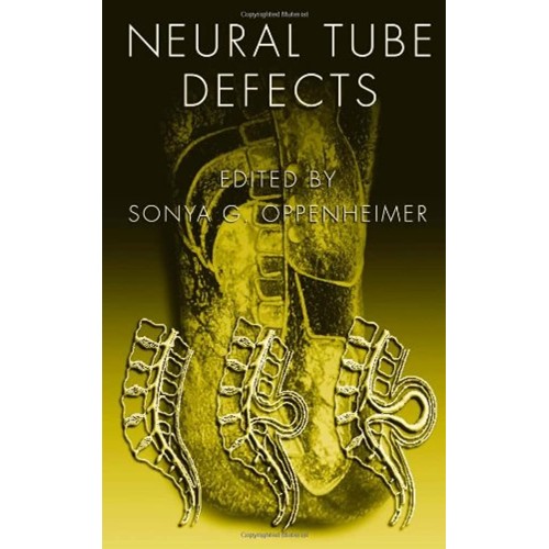 Neural Tube Defects Vol 14 (Hb 2007)