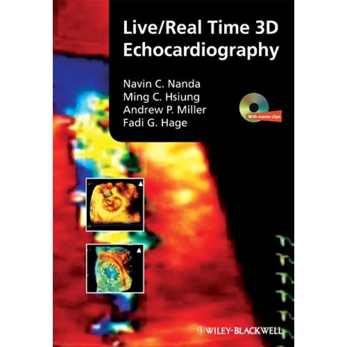 Live/Real Time 3D Echocardiography 