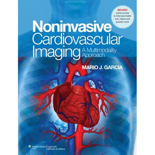 Noninvasive Cardiovascular Imaging: A Multimo...