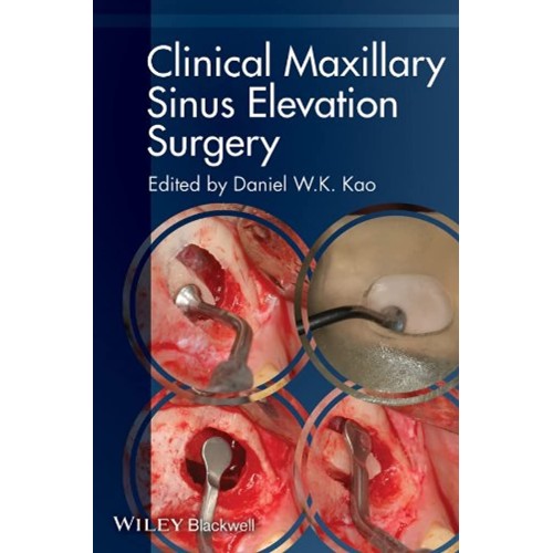 Clinical Maxillary Sinus Elevation Surgery (P...