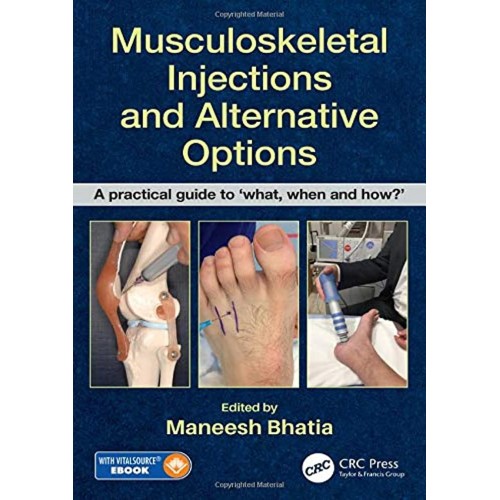 Musculoskeletal Injections And Alternative Op...