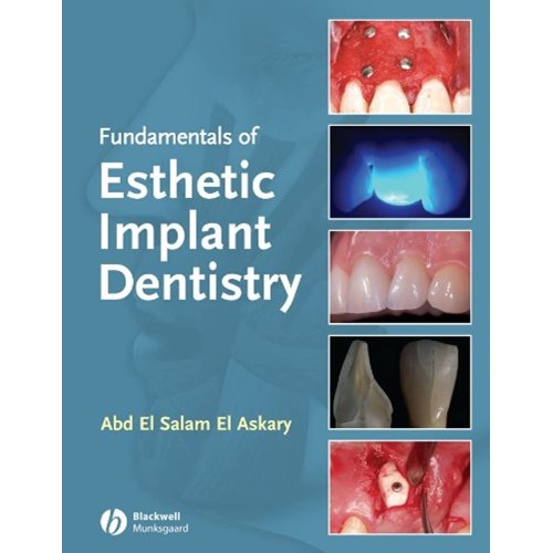 Fundamentals Of Esthetic Implant Dentistry (H...