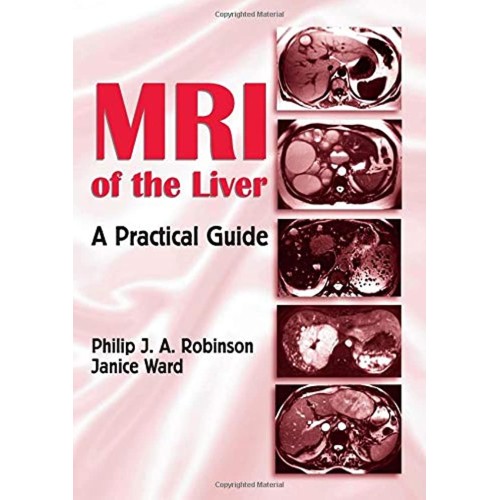 Mri Of The Liver A Practical Guide 