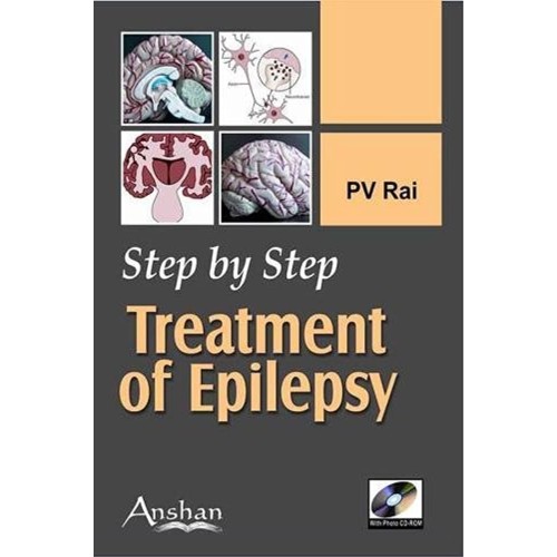 Step By Step Treatment Of Epilepsy 