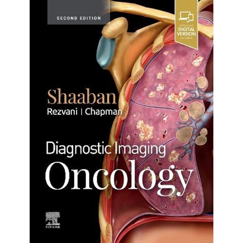 Diagnostic Imaging Oncology With Access Code ...