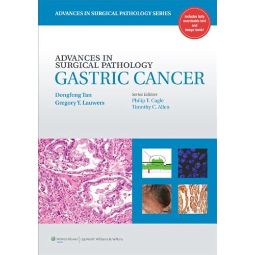 Advances In Surgical Pathology: Gastric Cance...