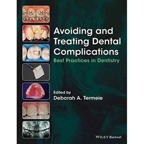 Avoiding And Treating Dental Complications Be...